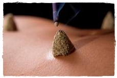 5 Element Acupuncture Dublin - Moxa Cones